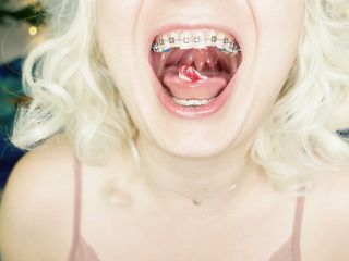 Braces Fetish: Asmr Video Of Eating Mukbang…